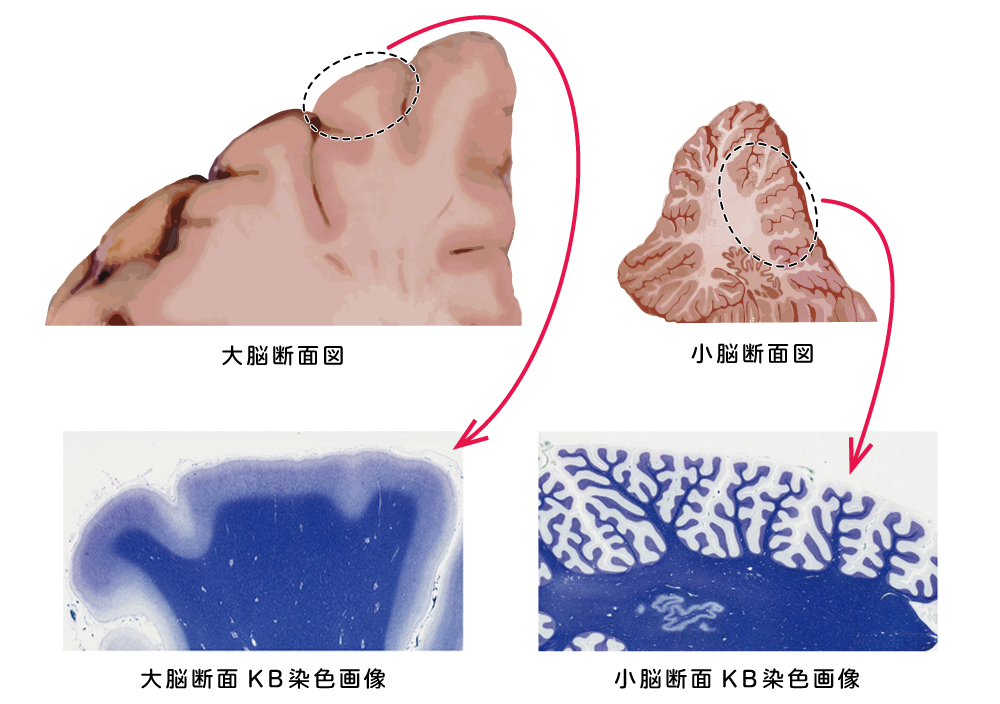 小脳hp14