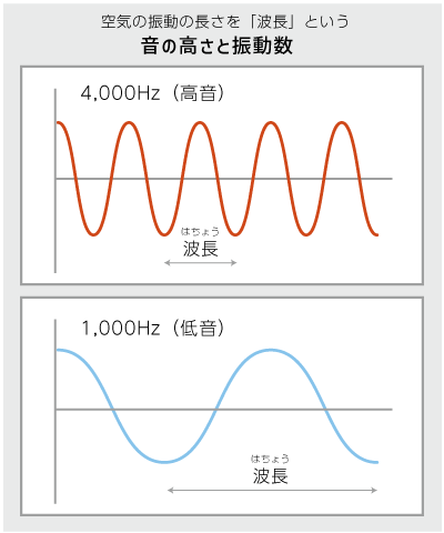 横側頭回hp15